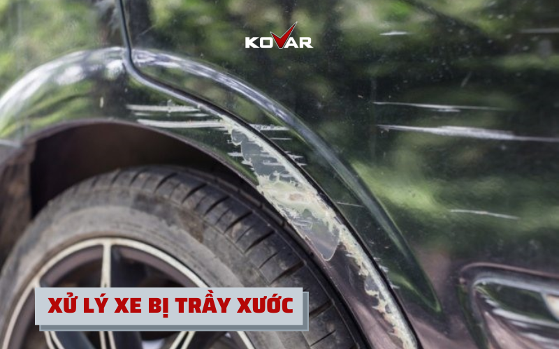 XU-LY-XE-BI-TRAY-XUOC